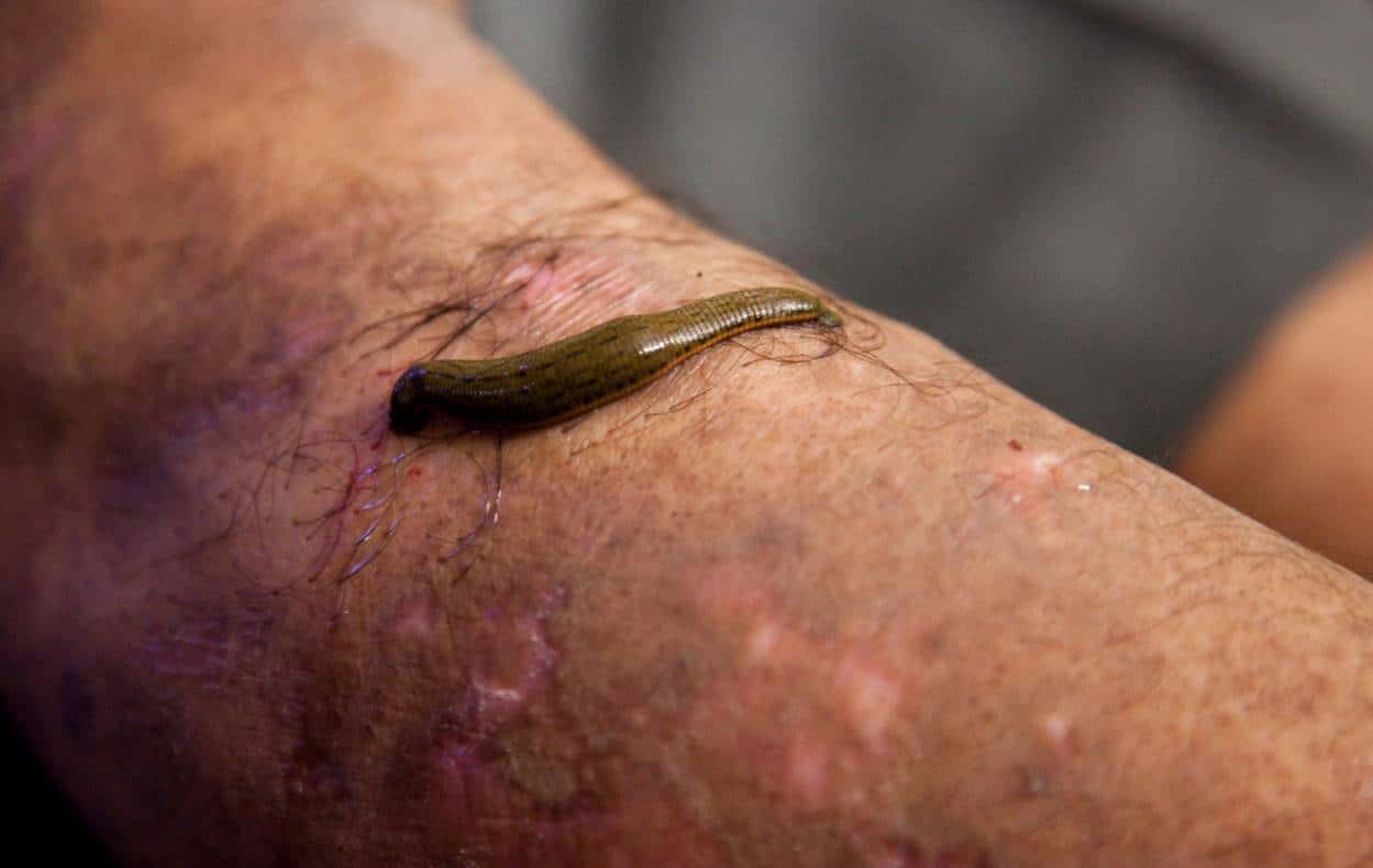 dream about leeches